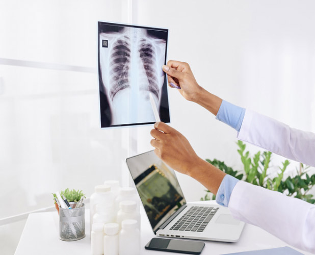 Флюорография и рентген